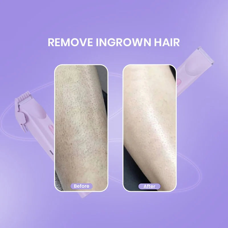 2 in 1 Women Body Shaver