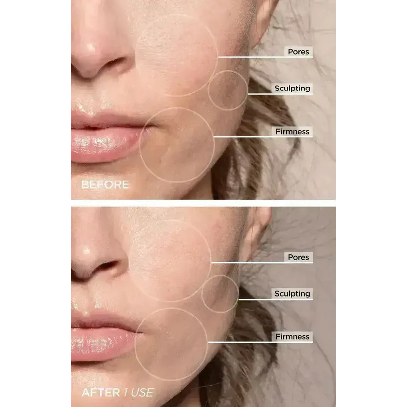 Magic Facelift Wand
