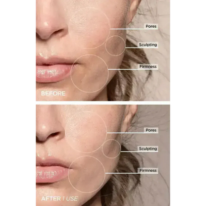 Magic Facelift Wand